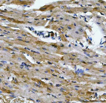Anti-Aconitase 2 Antibody (monoclonal, 4C12D1)