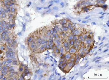 Anti-gamma Catenin Antibody (monoclonal, 4C12D7)