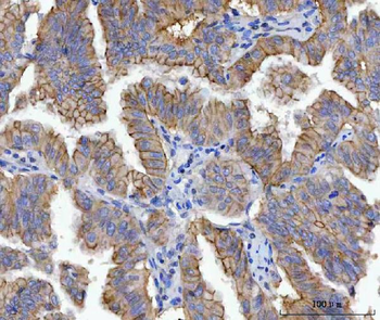Anti-gamma Catenin Antibody (monoclonal, 4C12D7)