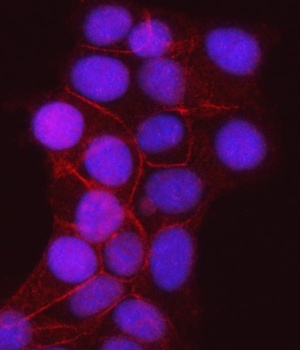 gamma Catenin Antibody (monoclonal, 4C12D7)