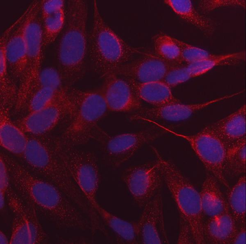 Anti-NDP52/CALCOCO2 Antibody (monoclonal, 9E2F2)