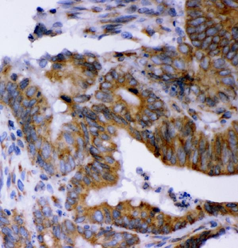 LYRIC Mouse Monoclonal Antibody