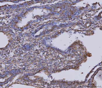 Anti-MDH2 Antibody (monoclonal, 5D8C1)