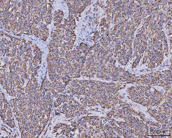 Anti-MDH2 Antibody (monoclonal, 5D8C1)
