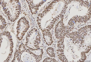 Anti-PC4/SUB1 Antibody (monoclonal, 8D9D1)
