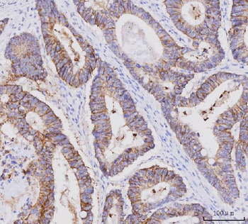 Anti-Claudin 3/CLDN3 Antibody (monoclonal, 4C7D2)