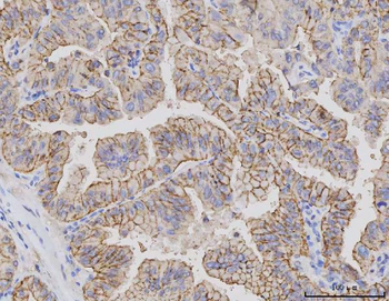 Anti-Claudin 3/CLDN3 Antibody (monoclonal, 4C7D2)