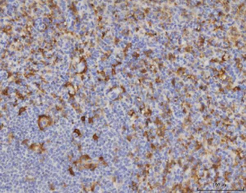 Anti-ME1 Antibody (monoclonal, 5E5F7)