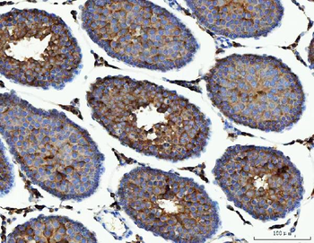 Anti-ME1 Antibody (monoclonal, 5E5F7)