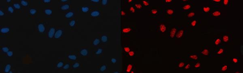 Anti-CPSF6 Antibody (monoclonal, 3F11E1)