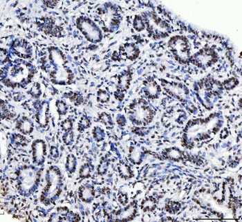Anti-CPSF6 Antibody (monoclonal, 3F11E1)