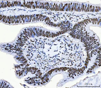 Anti-CPSF6 Antibody (monoclonal, 3F11E1)