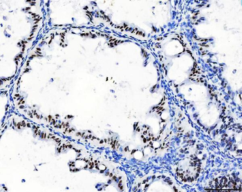 Anti-CPSF6 Antibody (monoclonal, 3F11E1)