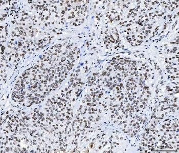 Anti-CPSF6 Antibody (monoclonal, 3F11E1)