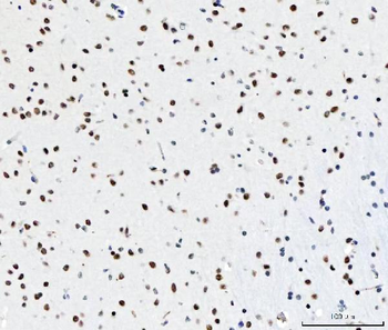 CPSF6 Antibody (monoclonal, 3F11E1)