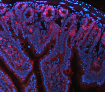 Anti-NKCC1/SLC12A2 Antibody (monoclonal, 6G7D2)