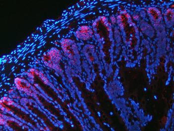 Anti-NKCC1/SLC12A2 Antibody (monoclonal, 6G7D2)