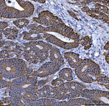 Anti-NKCC1/SLC12A2 Antibody (monoclonal, 6G7D2)