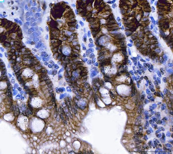 Anti-NKCC1/SLC12A2 Antibody (monoclonal, 6G7D2)