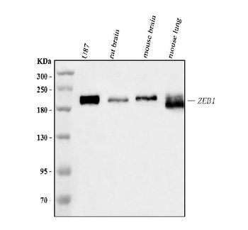 AREB6/ZEB1 Antibody (monoclonal, 8B12D7)
