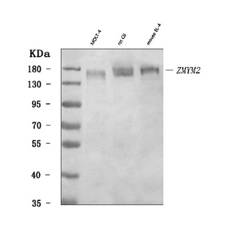 RAMP/ZMYM2 Antibody