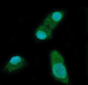 Anti-YTHDC2 Antibody