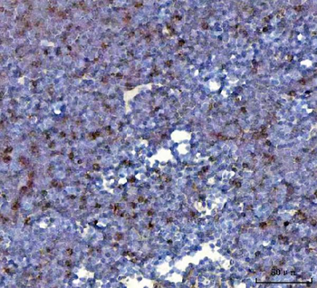 Anti-CCXCR1/XCR1 Antibody