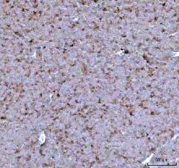 Anti-CCXCR1/XCR1 Antibody