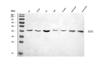 Anti-CCXCR1/XCR1 Antibody