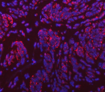 Anti-VPS53 Antibody
