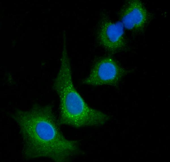 Anti-VPS53 Antibody