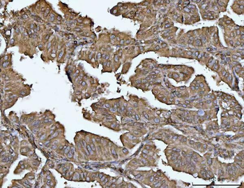 Anti-VPS53 Antibody
