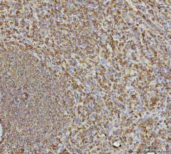 Anti-VPS53 Antibody