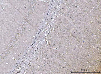 Anti-VPS53 Antibody