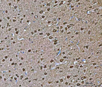 Anti-VPS53 Antibody