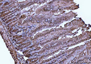 Anti-VCP Antibody