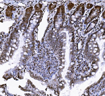 Anti-VCP Antibody