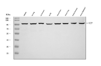 Anti-VCP Antibody