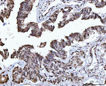 Anti-USP26 Antibody