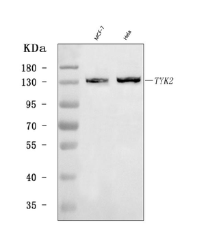 Anti-TYK2 Antibody