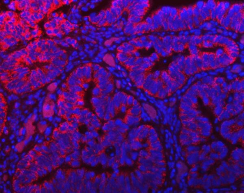 Anti-TOMM40 Antibody