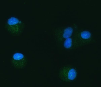 Anti-TOMM40 Antibody