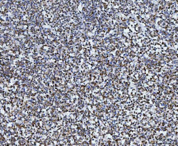 Anti-TOMM40 Antibody