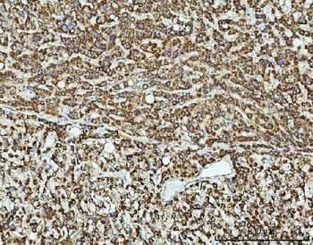 Anti-TOMM40 Antibody