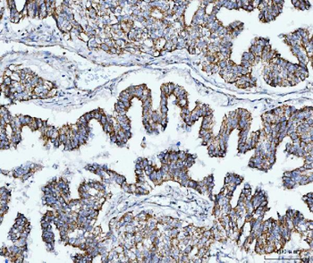 Anti-TOMM40 Antibody