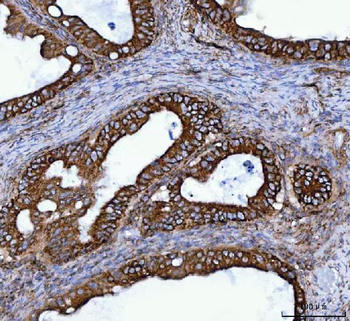 Anti-TOMM40 Antibody
