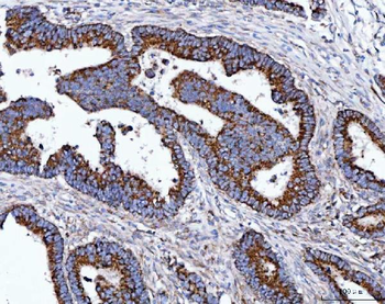 Anti-TOMM40 Antibody
