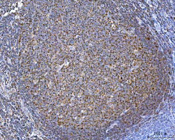 Anti-TOMM40 Antibody