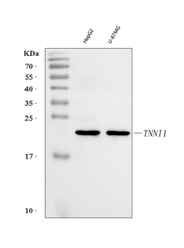 Anti-TNNI1 Antibody