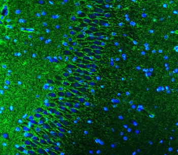 Anti-EAAT1/SLC1A3 Antibody